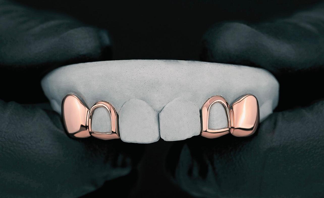 Open Face And Solid Grillz