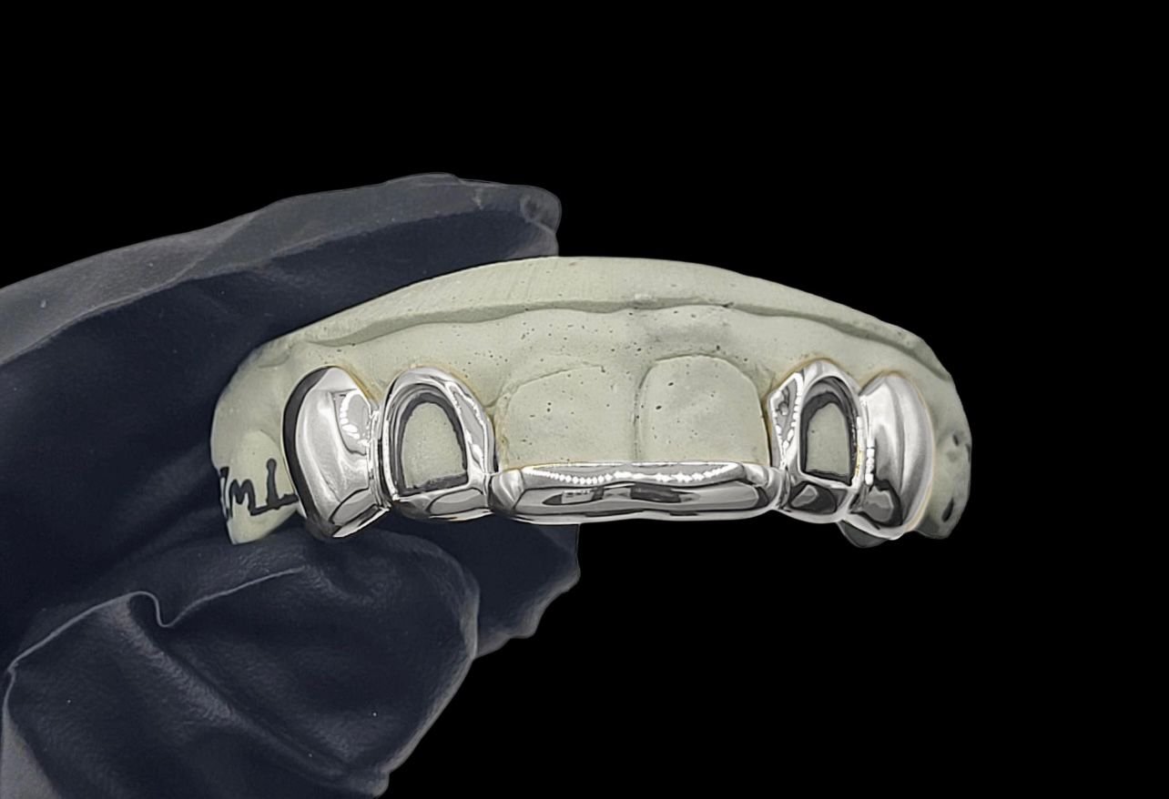 6-Piece Custom Grillz – Solid Front Tips, Open Face & Solid Canines